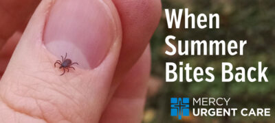 Photo of a tick on a thumb with the words "When Summer Bites Back"